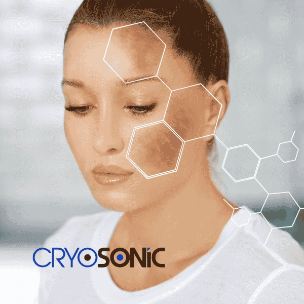 Are you looking for age spot removal treatment? Contact Cryosonic today in