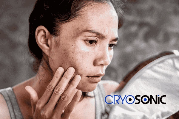 Book your sun damaged skin treatment online today in 