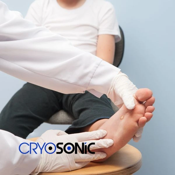 Are you looking for fast effective wart removal Contact us today 