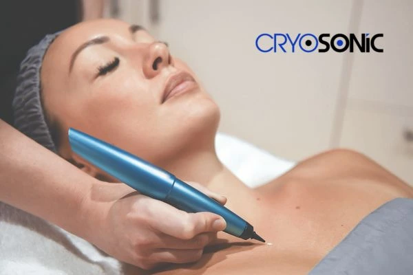 Cryosonic lesion removal prices book today! 